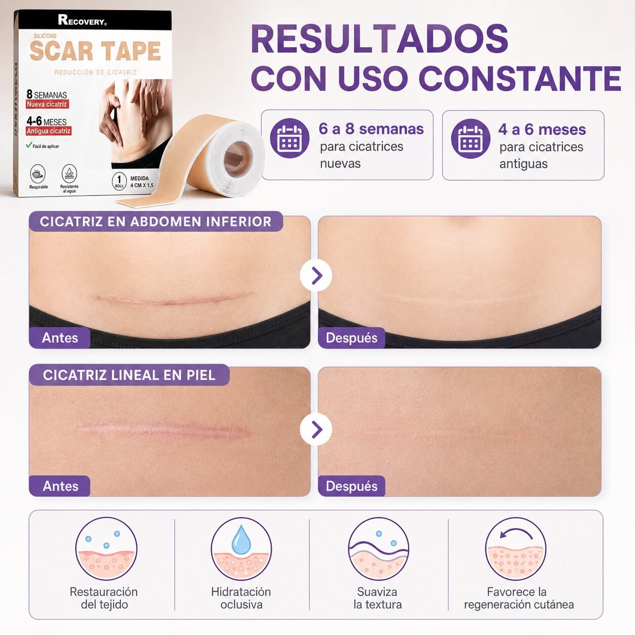 Parche de Silicona Recovery para Cicatrices 4 cm x 1,5 m